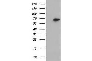 Western Blotting (WB) image for anti-Epoxide Hydrolase 2, Cytoplasmic (EPHX2) antibody (ABIN1500856) (EPHX2 抗体)