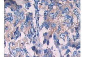 Used in DAB staining on fromalin fixed paraffin- embedded prostate gland tissue