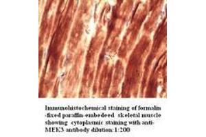 Image no. 1 for anti-Mitogen-Activated Protein Kinase Kinase 3 (MAP2K3) antibody (ABIN790902) (MAP2K3 抗体)