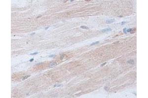 Immunohistochemical staining of formalin-fixed paraffin-embedded human skeletal muscle tissue showing cytoplasmic staining with ACTRT2 polyclonal antibody  at 1 : 100 dilution. (ACTRT2 抗体  (C-Term))