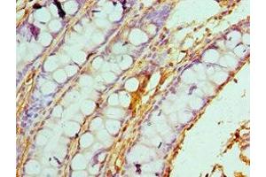 Immunohistochemistry of paraffin-embedded human colon tissue using ABIN7146462 at dilution of 1:100 (Caldesmon 抗体  (AA 1-240))