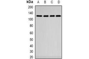 Western Blotting (WB) image for anti-SWI/SNF-Related, Matrix-Associated Actin-Dependent Regulator of Chromatin, Subfamily A, Containing DEAD/H Box 1 (SMARCAD1) antibody (ABIN7308348)