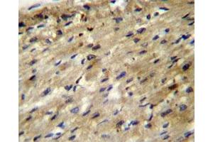 ABCD2 antibody immunohistochemistry analysis in formalin fixed and paraffin embedded human heart tissue. (CCL17 抗体  (AA 553-582))