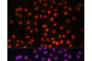 Immunofluorescence analysis of HeLa cells using TFEB Polyclonal Antibody at dilution of 1:100. (TFEB 抗体)