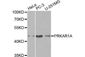 Western blot analysis of extracts of various cell lines, using PRKAR1A antibody (ABIN5970330) at 1/1000 dilution.