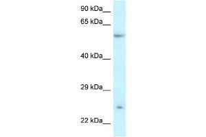 WB Suggested Anti-DERL3 Antibody Titration:  0. (Derlin-3 抗体  (Middle Region))