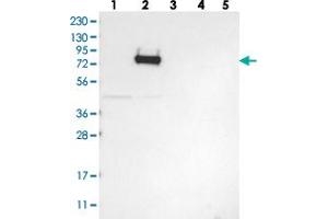 Western blot analysis of Lane 1: RT-4, Lane 2: U-251 MG, Lane 3: Human Plasma, Lane 4: Liver, Lane 5: Tonsil with GLT25D2 polyclonal antibody . (GLT25D2 抗体)