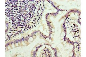 Immunohistochemistry of paraffin-embedded human small intestine tissue using ABIN7171285 at dilution of 1:100 (TRBC1 抗体  (AA 1-176))