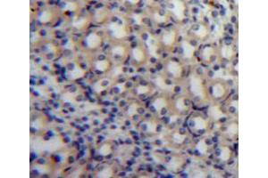 Used in DAB staining on fromalin fixed paraffin-embedded kidney tissue (S100A3 抗体  (AA 1-101))