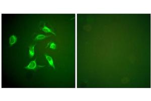 Immunofluorescence analysis of HeLa cells, using PDGFR alpha antibody. (PDGFRA 抗体  (C-Term))