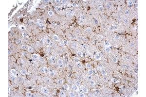 Immunohistochemistry (IHC) image for anti-Ionized Calcium-binding Adapter Molecule 1 (IBA1) (C-Term) antibody (ABIN2857032)