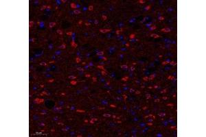 Immunofluorescence (Paraffin-embedded Sections) (IF (p)) image for anti-ATP Synthase, H+ Transporting, Mitochondrial F0 Complex, Subunit C1 (Subunit 9) (ATP5G1) antibody (ABIN7073141)