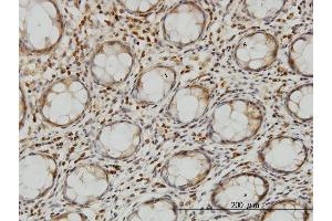 Immunoperoxidase of monoclonal antibody to LZTFL1 on formalin-fixed paraffin-embedded human colon. (LZTFL1 抗体  (AA 200-299))