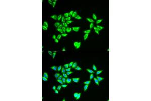 Immunofluorescence analysis of MCF-7 cell using PTRH2 antibody. (PTRH2 抗体)