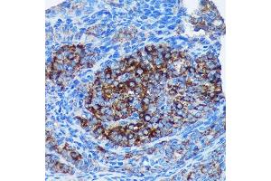 Immunohistochemistry of paraffin-embedded Rat ovary using MRPL30 Rabbit pAb (ABIN7268567) at dilution of 1:100 (40x lens). (MRPL30 抗体  (AA 1-161))