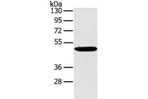 Western Blot analysis of Huvec cell using PPP2R3C Polyclonal Antibody at dilution of 1:400 (PPP2R3C 抗体)