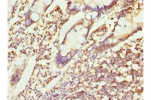 Immunohistochemistry of paraffin-embedded human small intestine tissue using ABIN7147524 at dilution of 1:100 (CHMP4B 抗体  (AA 1-224))