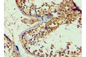Immunohistochemistry (IHC) image for anti-Amyloid beta (A4) Precursor Protein-Binding, Family B, Member 1 (Fe65) (APBB1) (AA 361-710) antibody (ABIN7144040)