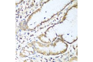 Immunohistochemistry of paraffin-embedded human stomach using NUDT15 antibody. (NUDT15 抗体  (AA 1-164))