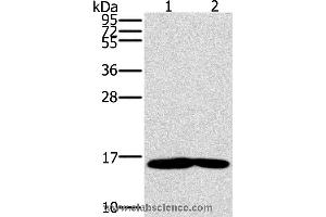 Western blot analysis of Mouse heart and muscle tissue, using MB Polyclonal Antibody at dilution of 1:600 (MTMR3 抗体)