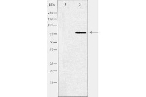 Western blot analysis of extracts from COLO cells, using ABCB10 antibody.