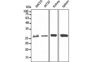 Western Blotting (WB) image for anti-RAB11B, Member RAS Oncogene Family (RAB11B) (C-Term) antibody (ABIN1440027) (RAB11B 抗体  (C-Term))