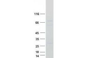 Western Blotting (WB) image for CCR4-NOT Transcription Complex Subunit 4 (CNOT4) (Transcript Variant 2) protein (Myc-DYKDDDDK Tag) (ABIN2712911)