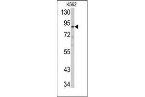 Image no. 1 for anti-ATP-Binding Cassette, Sub-Family B (MDR/TAP), Member 5 (ABCB5) (N-Term) antibody (ABIN358601)