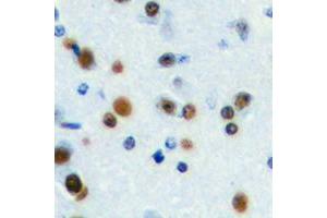 Immunohistochemical analysis of ANKRD30A staining in human brain formalin fixed paraffin embedded tissue section. (ANKRD30A 抗体  (C-Term))