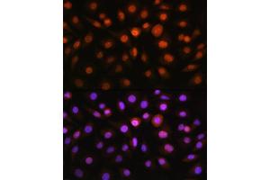 Immunofluorescence analysis of L929 cells using DDIT3/CHOP antibody (ABIN3020709, ABIN3020710, ABIN3020711, ABIN1512759 and ABIN6213685) at dilution of 1:100.