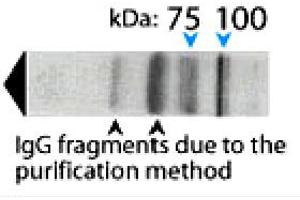 Western blot analysis on human brain lysate under reducing conditions using AP1B1 polyclonal antibody  at a dilution of 1 : 100. (AP1B1 抗体  (AA 11-29))