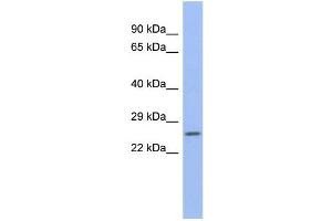 WB Suggested Anti-ZNRF1 Antibody Titration:  0. (ZNRF1 抗体  (N-Term))