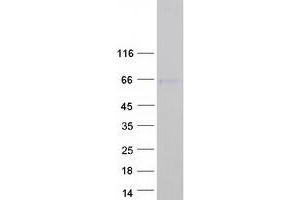 Western Blotting (WB) image for SRY (Sex Determining Region Y)-Box 8 (SOX8) protein (Myc-DYKDDDDK Tag) (ABIN2732471)