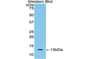 Western blot analysis of the recombinant protein. (AMH 抗体)