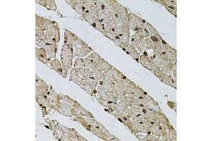Immunohistochemistry of paraffin-embedded mouse heart using PHF1 antibody (ABIN5974685) at dilution of 1/100 (40x lens). (PHF1 抗体)