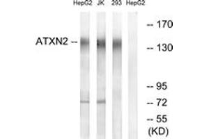 Western Blotting (WB) image for anti-Ataxin 2 (ATXN2) (AA 731-780) antibody (ABIN2890136) (Ataxin 2 抗体  (AA 731-780))