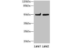 Western blot All lanes: TUBB6 antibody at 4 μg/mL Lane 1: Hela whole cell lysate Lane 2: MDA-MB-231 whole cell lysate Secondary Goat polyclonal to rabbit IgG at 1/10000 dilution Predicted band size: 50 kDa Observed band size: 50 kDa (TUBb6 抗体  (AA 1-446))