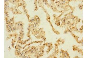 Immunohistochemistry of paraffin-embedded human lung tissue using ABIN7159336 at dilution of 1:100 (PAQR5 抗体  (AA 1-51))