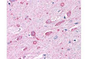 Anti-MC4 Receptor antibody IHC of human brain. (MC4R 抗体  (N-Term))