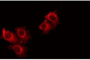 ABIN6274806 staining HeLa by IF/ICC. (ACOT4 抗体  (C-Term))