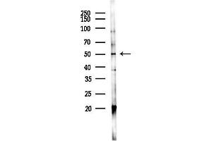 Western blot analysis of lysates from K562 cells(UV 30 min treatment), using TRHR Antibody at 1/1000 dilution.