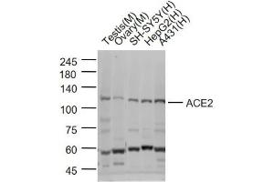 Lane 1: Mouse Testis lysates; Lane 2:Mouse Ovary lysates; Lane 3: SH-SY5Y cell lysates; Lane 4: HepG2 cell lysates; Lane 5: A431 cell lysates probed with ACE2 Polyclonal Antibody, Unconjugated (bs-23444R) at 1:1000 dilution and 4˚C overnight incubation.