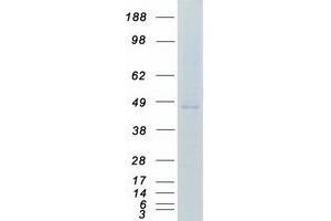 Western Blotting (WB) image for Casein Kinase 1, epsilon (CSNK1E) (Transcript Variant 1) protein (Myc-DYKDDDDK Tag) (ABIN2713193)