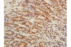 Formalin-fixed and paraffin embedded rat stomach labeled with Rabbit Rabbit Anti-CISD1 Polyclonal Antibody, Unconjugated (ABIN2173059) at 1:200 followed by conjugation to the secondary antibody and DAB staining (CISD1 抗体  (AA 51-108))