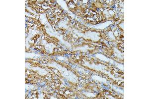 Immunohistochemistry of paraffin-embedded mouse kidney using IVD antibody (ABIN7268031) at dilution of 1:100 (40x lens). (IVD 抗体  (AA 33-200))