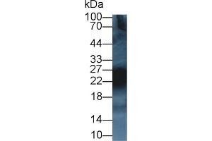 Detection of CD99 in Rat Thymus lysate using Polyclonal Antibody to Cluster Of Differentiation 99 (CD99) (CD99 抗体  (AA 26-160))