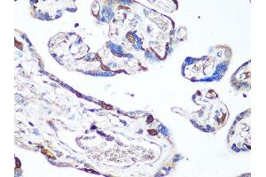 Immunohistochemistry of paraffin-embedded human placenta using MAPK14 antibody (ABIN6291833) at dilution of 1:100 (40x lens). (MAPK14 抗体)