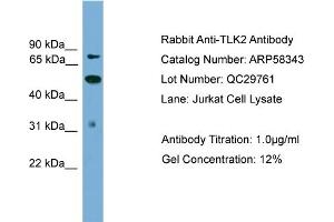 WB Suggested Anti-TLK2  Antibody Titration: 0. (TLK2 抗体  (N-Term))