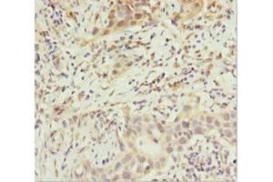 Immunohistochemistry (IHC) image for anti-ATP-Binding Cassette, Sub-Family B (MDR/TAP), Member 8 (ABCB8) (AA 486-735) antibody (ABIN7144897)