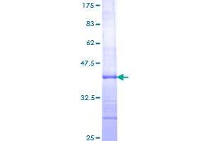 Image no. 1 for Interleukin 12 beta (IL12B) (AA 229-328) protein (GST tag) (ABIN1307678) (IL12B Protein (AA 229-328) (GST tag))